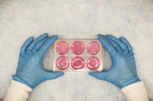 $700,000 boost for NZ scientists at the forefront of tackling breast cancer